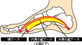 アーチを第一に考えたインソール