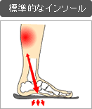 標準的なインソール／”アーチ”を支えようとするとふくらはぎ等への負担が増加